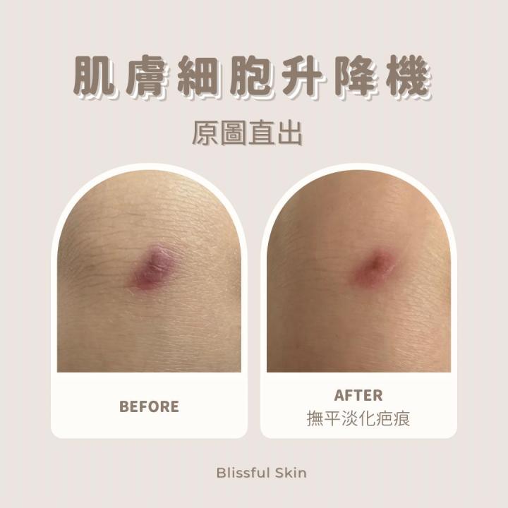 清除皮膚表層老廢角質、油脂