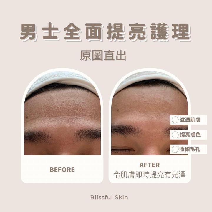 要先將黑頭油脂浮上表面,令到之後針清容易處理