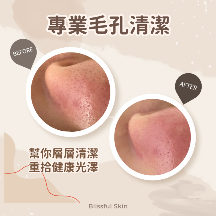 專業毛孔清潔幫你層層清潔重拾健康光澤