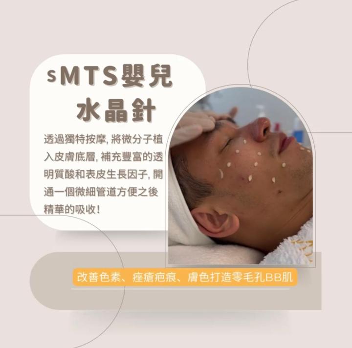 要先將黑頭油脂浮上表面,令到之後針清容易處理