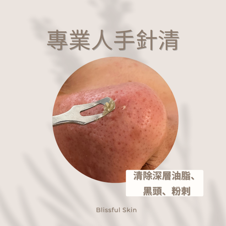 清除皮膚表層老廢角質、油脂