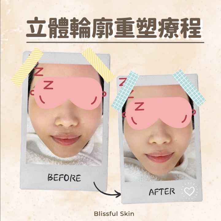 專業毛孔清潔幫你層層清潔重拾健康光澤