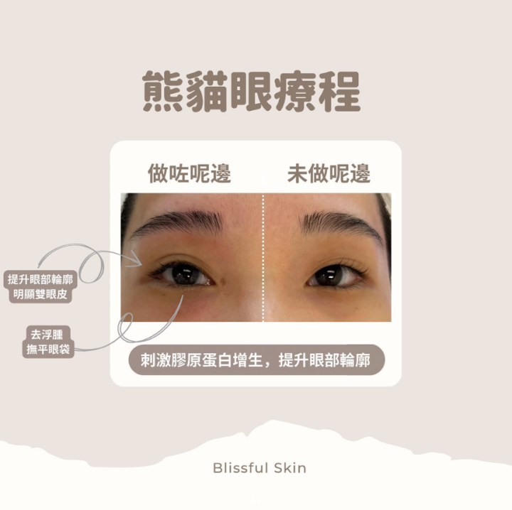 專業毛孔清潔幫你層層清潔重拾健康光澤